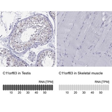 Anti-C11orf63 Prestige Antibodies&#174; Powered by Atlas Antibodies, affinity isolated antibody