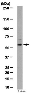 Anti-Neurotensin Receptor 2 Antibody from rabbit, purified by affinity chromatography