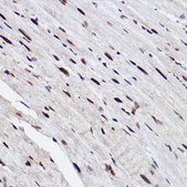 Anti-GTF2I Antibody, clone 5B6D1, Rabbit Monoclonal