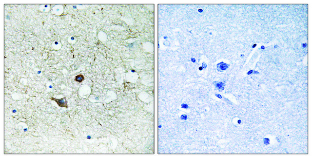 Anti-CASP2 antibody produced in rabbit affinity isolated antibody