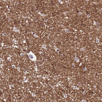 Anti-NLRP11 antibody produced in rabbit Prestige Antibodies&#174; Powered by Atlas Antibodies, affinity isolated antibody, buffered aqueous glycerol solution