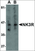 Anti-NK3R antibody produced in rabbit affinity isolated antibody, buffered aqueous solution
