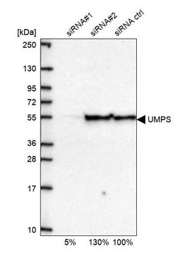 Anti-UMPS antibody produced in rabbit Prestige Antibodies&#174; Powered by Atlas Antibodies, affinity isolated antibody, buffered aqueous glycerol solution