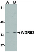 Anti-WDR92 antibody produced in rabbit affinity isolated antibody, buffered aqueous solution