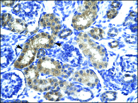 Anti-SIX6 antibody produced in rabbit affinity isolated antibody