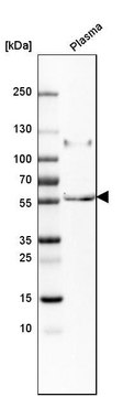 抗-PI16 兔抗 Prestige Antibodies&#174; Powered by Atlas Antibodies, affinity isolated antibody, buffered aqueous glycerol solution