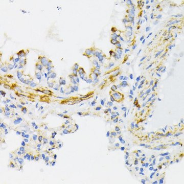 Anti-Cytochrome C antibody produced in rabbit