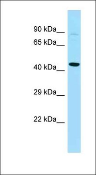 Anti-PFKFB4 antibody produced in rabbit affinity isolated antibody