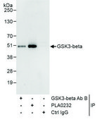 Rabbit anti-GSK3-beta Antibody, Affinity Purified Powered by Bethyl Laboratories, Inc.