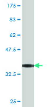 Monoclonal Anti-TNKS antibody produced in mouse clone 1A3, purified immunoglobulin, buffered aqueous solution