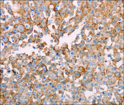 Anti-GNA11 antibody produced in rabbit affinity isolated antibody