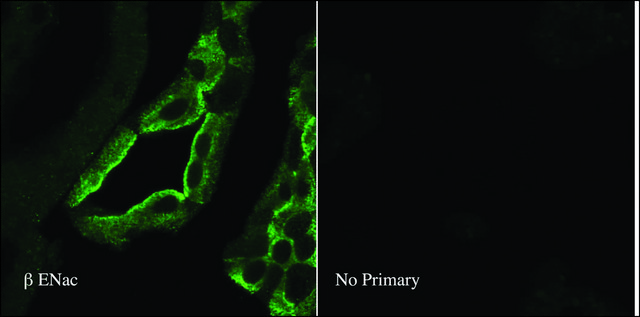 抗SCNN1B 兔抗 1&#160;mg/mL, affinity isolated antibody