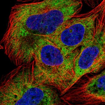 Anti-NAA20 antibody produced in rabbit Prestige Antibodies&#174; Powered by Atlas Antibodies, affinity isolated antibody