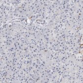 Anti-WIPF1 antibody produced in rabbit Prestige Antibodies® Powered by Atlas Antibodies, affinity isolated antibody, buffered aqueous glycerol solution