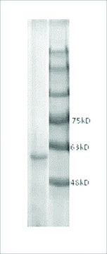 CETP human recombinant, expressed in insect cells, &#8805;90% (SDS-PAGE)