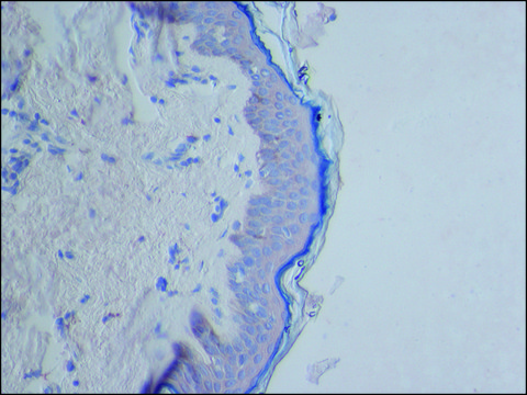 Anti-CYLD (C-terminal) antibody produced in rabbit ~1.0&#160;mg/mL, affinity isolated antibody