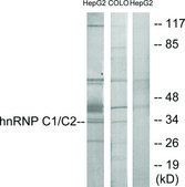 Anti-HNRNP C1 antibody produced in rabbit affinity isolated antibody