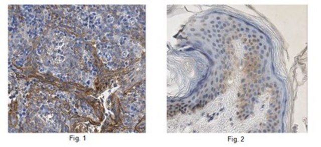 Anti-Desmoglein-3, clone 5G11 Antibody clone 5G11, from mouse