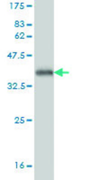 Monoclonal Anti-TREX1 antibody produced in mouse clone 2F10, purified immunoglobulin, buffered aqueous solution