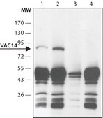 Anti-VAC14 (C-terminal) antibody produced in rabbit ~1.5 mg/mL, affinity isolated antibody, buffered aqueous solution