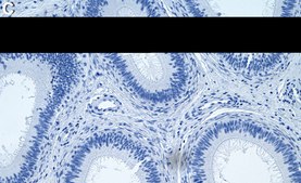 Anti-ECM1 Antibody, clone 1C6 ZooMAb® Rabbit Monoclonal recombinant, expressed in HEK 293 cells