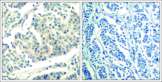 Anti-phospho-ABL1/ABL2 (pTyr393/429) antibody produced in rabbit affinity isolated antibody