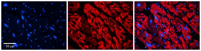 Anti-ECM1 antibody produced in rabbit affinity isolated antibody