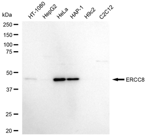 Anti ERCC8 Antibody, clone 23GB5905, Rabbit Monoclonal clone 23GB5905, recombinant rabbit monoclonal, expressed in HEK293 cells