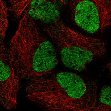 Anti-SMARCAL1 antibody produced in rabbit affinity isolated antibody, buffered aqueous glycerol solution