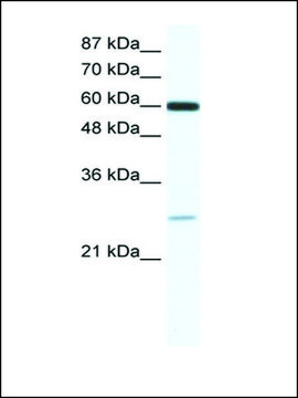 Anti-ZFP91 (AB1) antibody produced in rabbit affinity isolated antibody