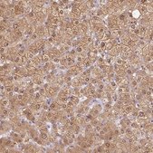 Anti-TMEM45A antibody produced in rabbit Prestige Antibodies® Powered by Atlas Antibodies, affinity isolated antibody, buffered aqueous glycerol solution