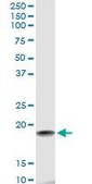 Monoclonal Anti-HSPB7 antibody produced in mouse clone 3E11, purified immunoglobulin, buffered aqueous solution