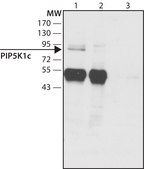 Anti-PIP5K1C (N-terminal) antibody produced in rabbit ~1 mg/mL, affinity isolated antibody, buffered aqueous solution