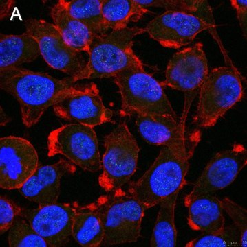 Anti-Notch1 Antibody, clone 1A32 ZooMAb&#174; Rabbit Monoclonal recombinant, expressed in HEK 293 cells