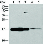 Anti-UBE2V1 affinity isolated antibody
