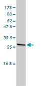 Monoclonal Anti-CLTB antibody produced in mouse clone 4B12-1E3, purified immunoglobulin, buffered aqueous solution