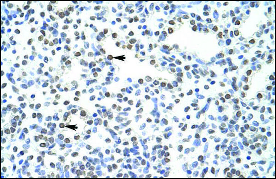 Anti-POGZ antibody produced in rabbit IgG fraction of antiserum