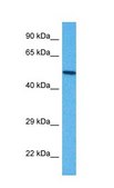 Anti-B3GALT2 antibody produced in rabbit affinity isolated antibody