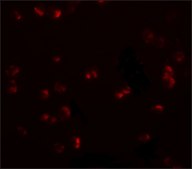 Anti-CHORDC1 antibody produced in rabbit affinity isolated antibody, buffered aqueous solution