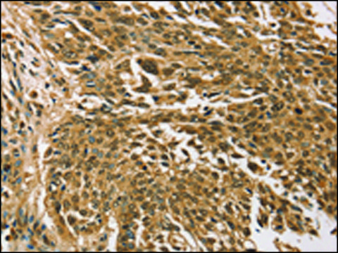 Anti-TGM7 affinity isolated antibody