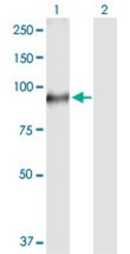 Anti-TGM1 antibody produced in rabbit purified immunoglobulin, buffered aqueous solution