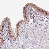 Anti-ONECUT2 antibody produced in rabbit Prestige Antibodies® Powered by Atlas Antibodies, affinity isolated antibody, buffered aqueous glycerol solution