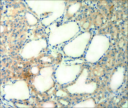 Anti-AGRN antibody produced in rabbit affinity isolated antibody