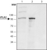 Anti-Phospholipase A2 (iPLA2) (C-terminal region) antibody produced in rabbit ~1.5 mg/mL, affinity isolated antibody