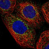 Anti-NME6 antibody produced in rabbit Prestige Antibodies® Powered by Atlas Antibodies, affinity isolated antibody, buffered aqueous glycerol solution