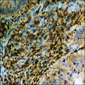 Anti-phospho-Interferon-γ Receptor α (pTyr457) antibody produced in rabbit affinity isolated antibody