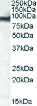 Anti-EWS/EWSR1 antibody produced in goat affinity isolated antibody, buffered aqueous solution