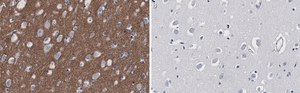 Anti-α-Synuclein Antibody, clone 2F12 ZooMAb® Mouse Monoclonal recombinant, expressed in HEK 293 cells