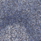 Anti-GTPBP10 antibody produced in rabbit Prestige Antibodies® Powered by Atlas Antibodies, affinity isolated antibody, buffered aqueous glycerol solution