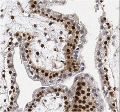 Anti-Lymphoid-specific helicase (SMARCA6) Antibody, clone 2G7.1 clone 2G7.1, from mouse